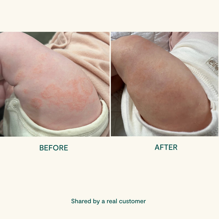 BEETL Baby Cream 250ml jar with a smooth, white cream, suitable for delicate baby skin and gentle skincare.